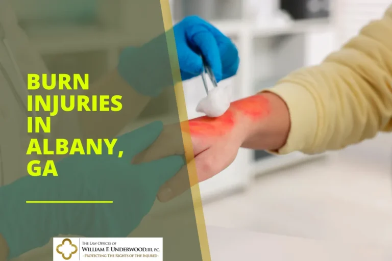 Person receiving medical treatment on a red burn injury on hand, text "Burn Injuries in Albany, GA".