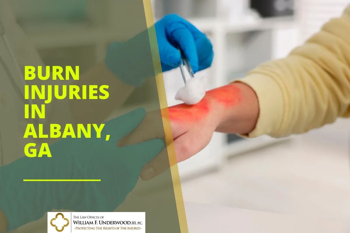 Person receiving medical treatment on a red burn injury on hand, text "Burn Injuries in Albany, GA".